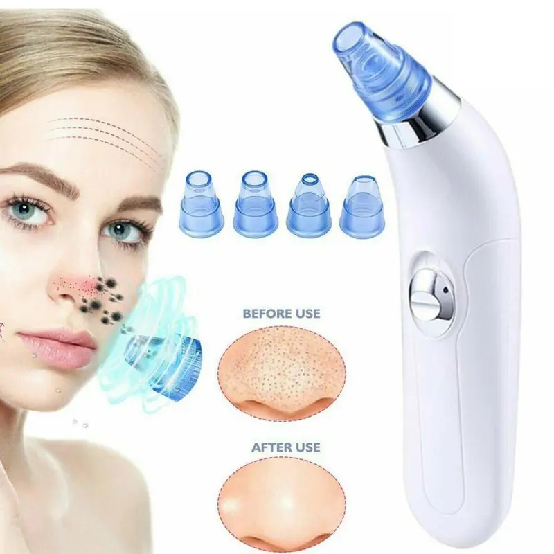 (NET) Derma Suction Pore Cleaning Device Blackhead Remover  Acne Pimple Pore Cleaner Vacuum Suction Tool For Men And Women / KC-31 / KZ-14